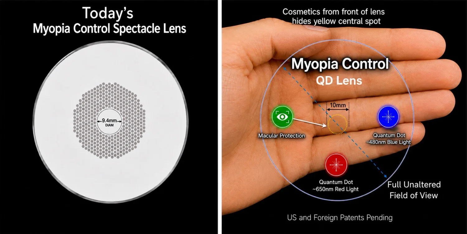 Inventive Lens Company Myopia Lens Therapy Spectacle Lens QD Lens